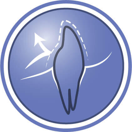 Βοηθά στην προστασία των δοντιών από την πλάκα και τη συσσώρευση πέτρας